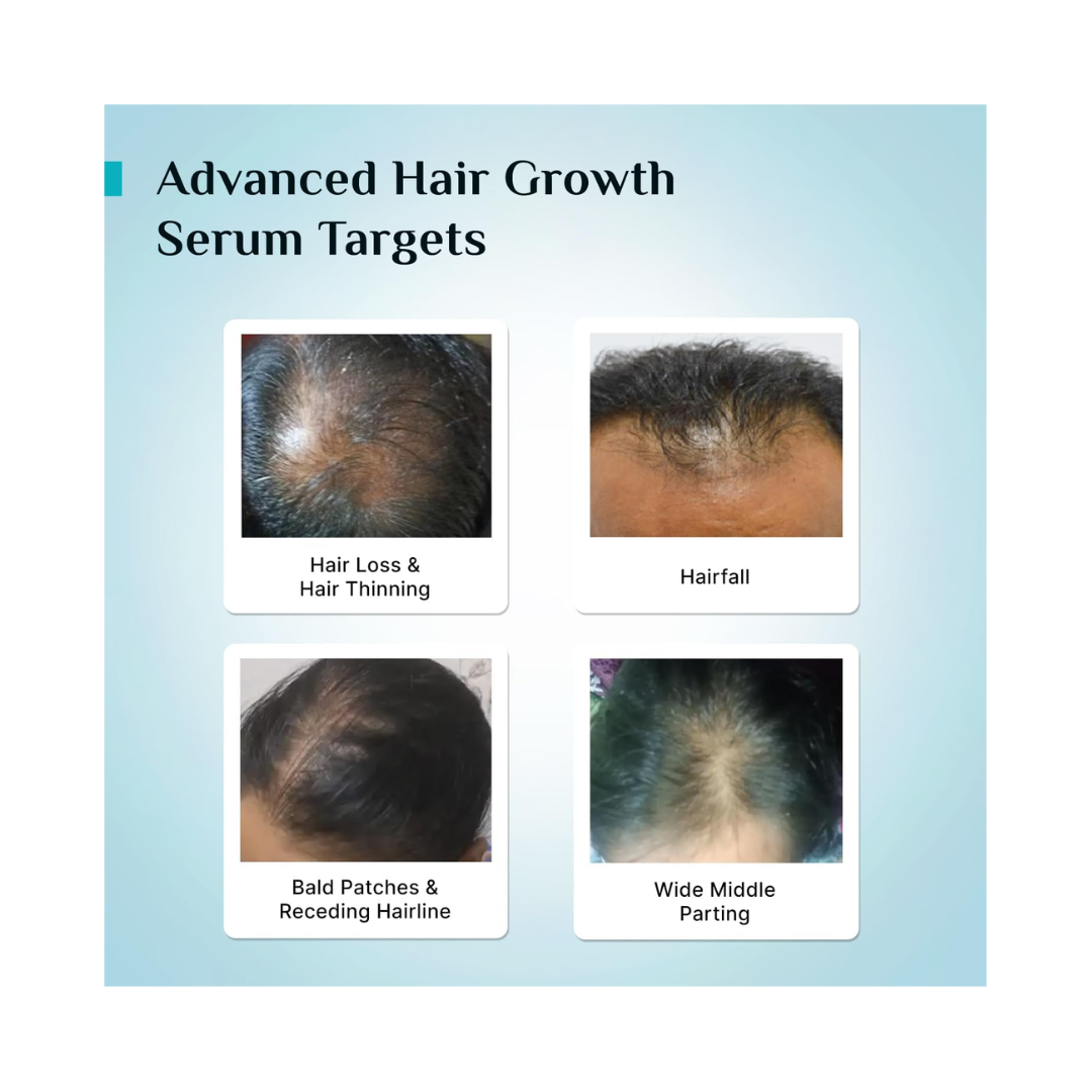 Pilgrim Hair Growth Serum – Redensyl 3% + Anagain 4% + Baicapil (30ml) - Kodomo store