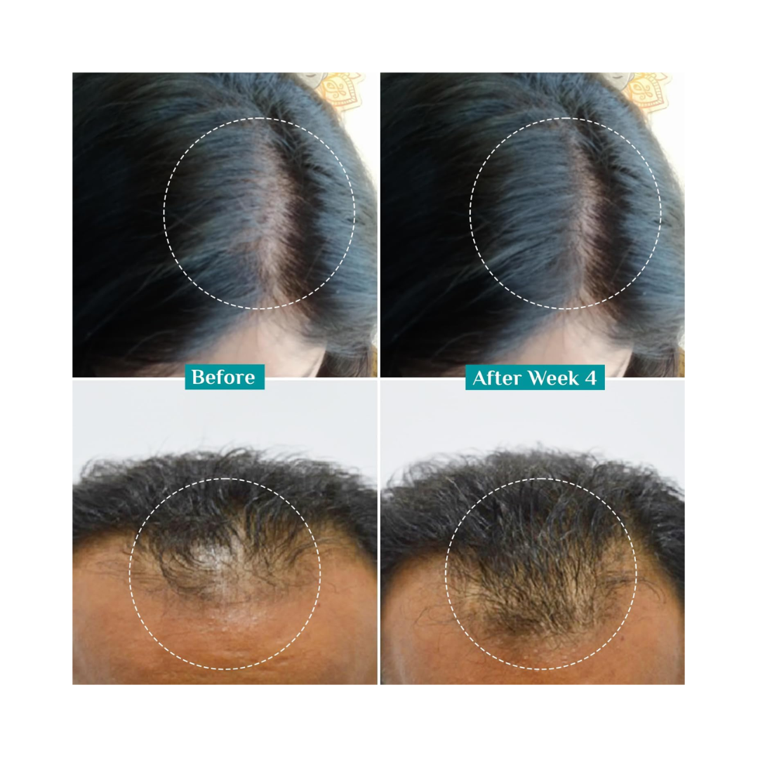 Pilgrim Hair Growth Serum – Redensyl 3% + Anagain 4% + Baicapil (30ml) - Kodomo store