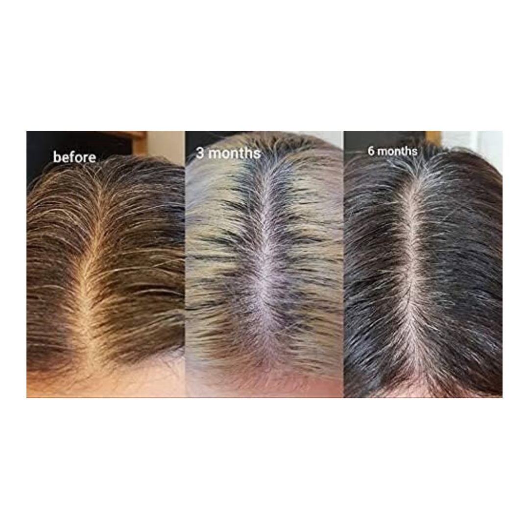 The Ordinary Multi-Peptide Hair Density Serum 60ml - Kodomo store