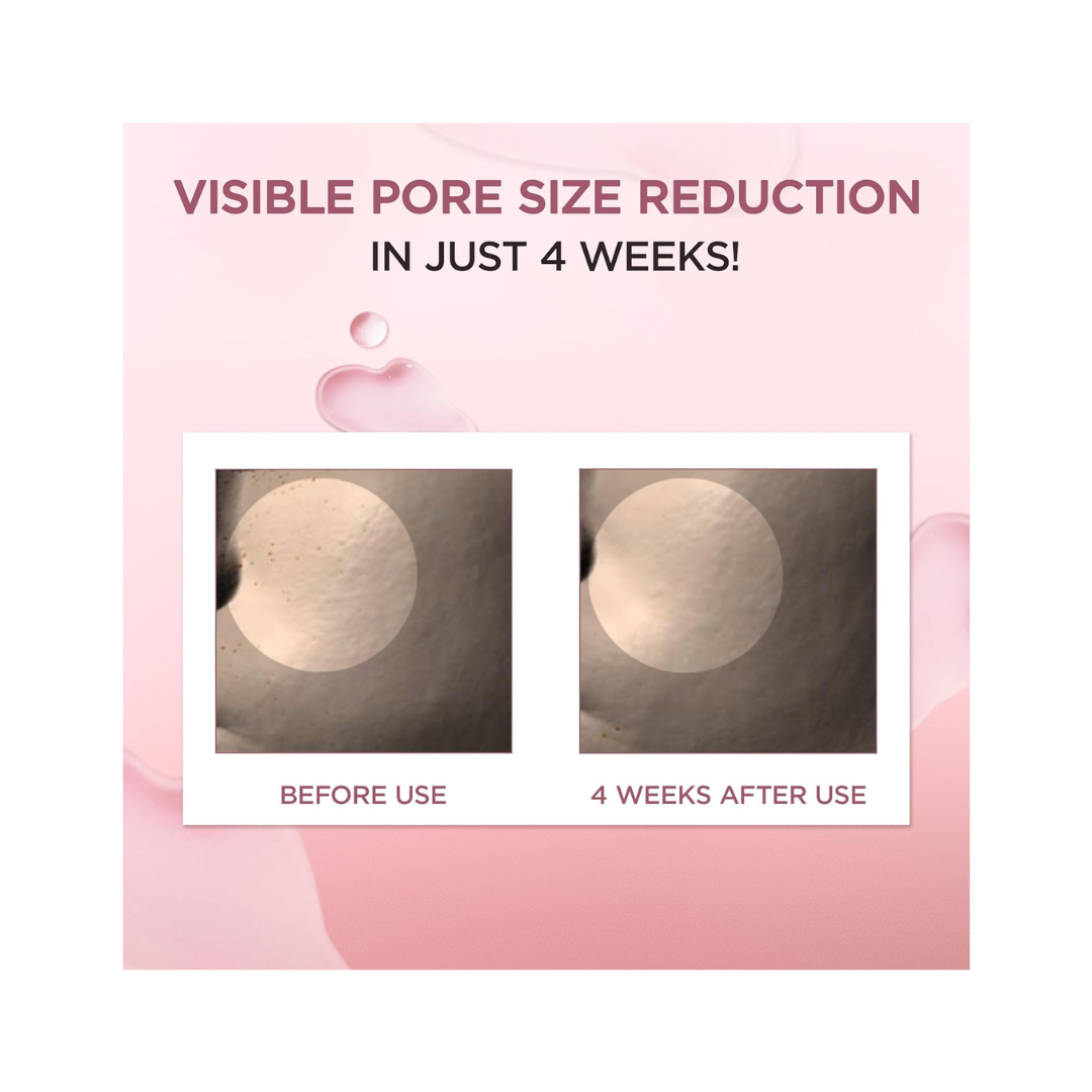 SKIN1004 Poremizing Ampoule – Centella & Pore Care