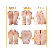 Exfoliating Magic Foot Socks – Callus Remover 1 Pair - Kodomo store