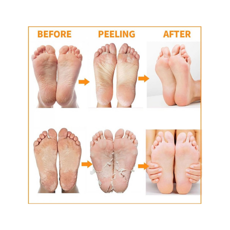Exfoliating Magic Foot Socks – Callus Remover 1 Pair - Kodomo store