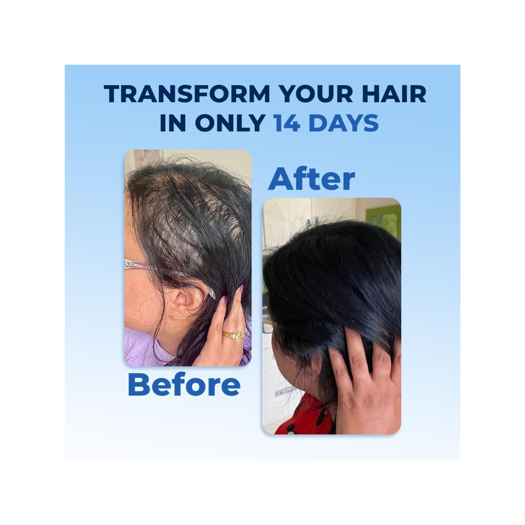 FEGPLUS Rosemary Beard & Hair Serum – 50ml - Kodomo store