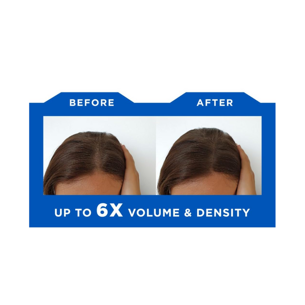 Hair ResQ Natural Thickening Conditioner for Dry Hair – 12 fl oz (355 ml) - Kodomo store