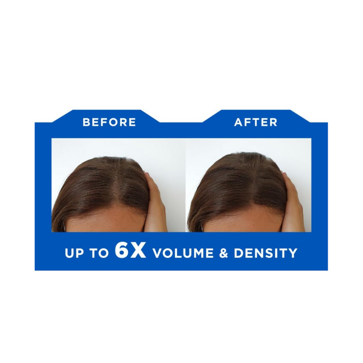 Hair ResQ Natural Thickening Conditioner for Dry Hair – 12 fl oz (355 ml) - Kodomo store