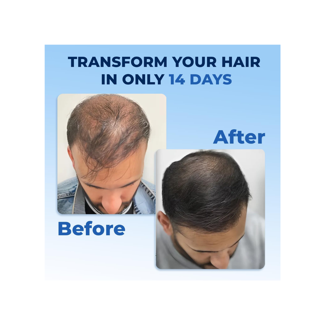 FEGPLUS Rosemary Beard & Hair Serum – 50ml