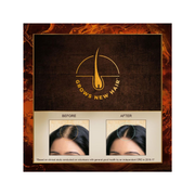 Indulekha Bringha Organic Hair Oil 100ml