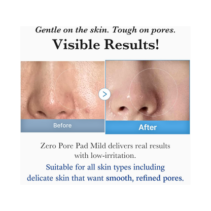 Medicube Zero Pore Pads Mild 2.0 - Kodomo store