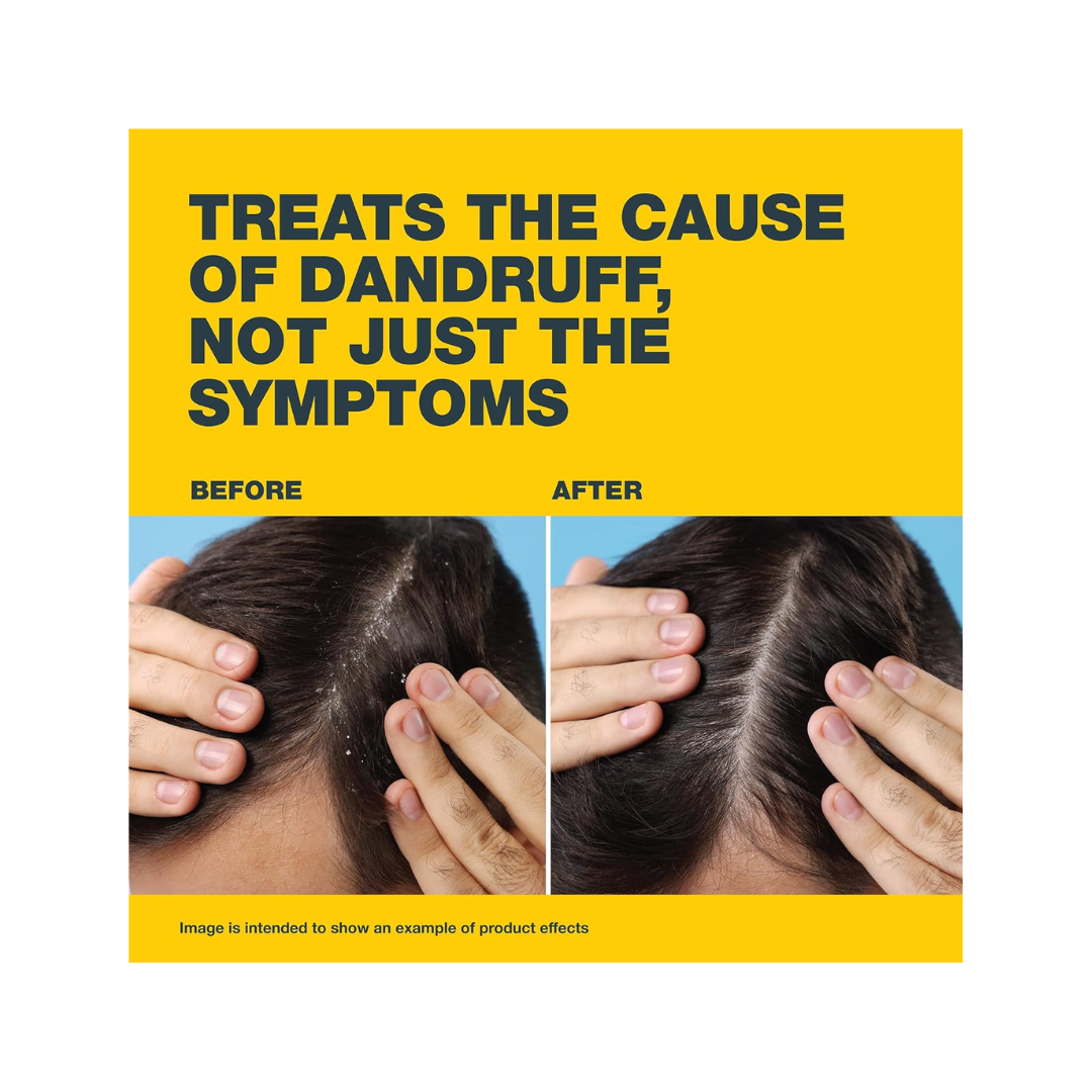 Nizoral 2% Anti-Dandruff Shampoo – 100ml - Kodomo store