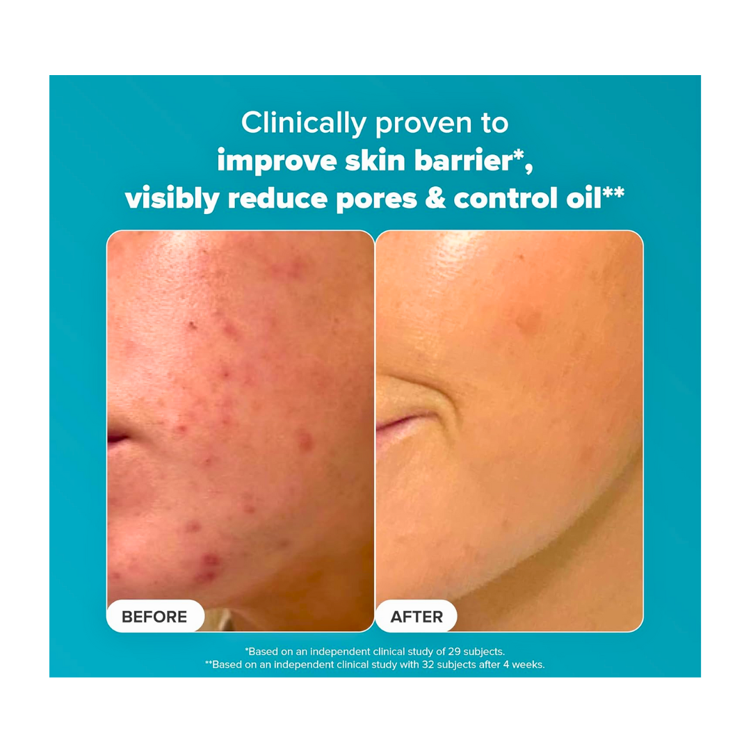 Paula’s Choice Skin Perfecting 2% BHA Liquid Exfoliant with Salicylic Acid 118ml - Kodomo store