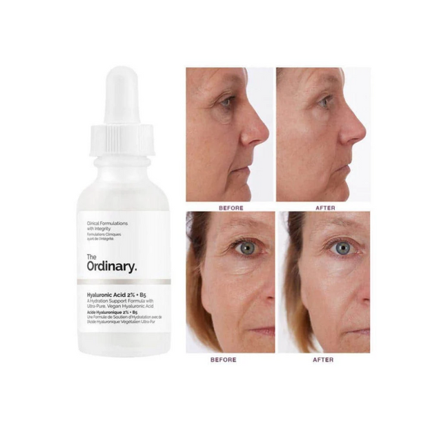 The Ordinary Hyaluronic Acid 2% + B5 30ml - Kodomo store
