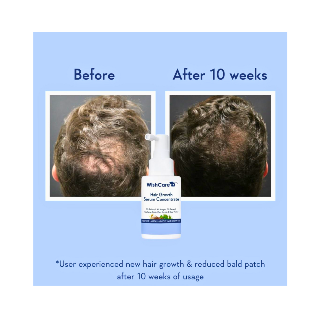 WishCare Hair Growth Serum – Redensyl, Anagain, Biotin (30ml) - Kodomo store